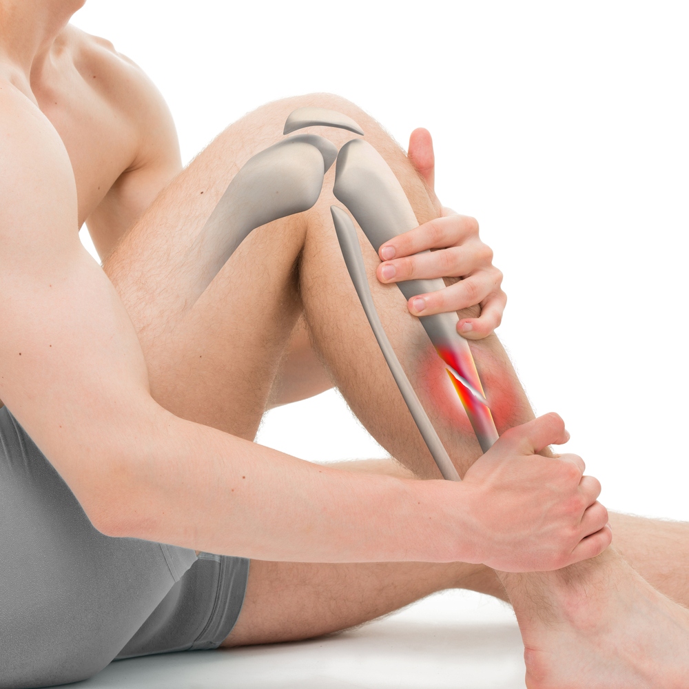 Illustration highlighting knee and leg pain along the leg