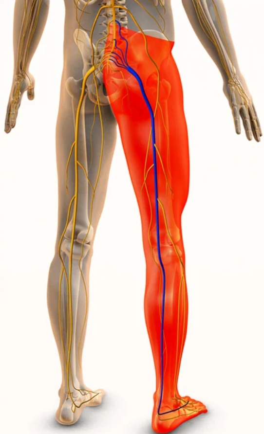 Illustration of the sciatic nerve pathway highlighting sciatica pain down the leg